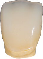 EMAX Crown- Excellent aesthetics