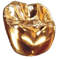 Gold Crown- High Strength but compromised aesthetics