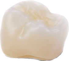 Zirconia Crown- Balance of strength and aesthetics