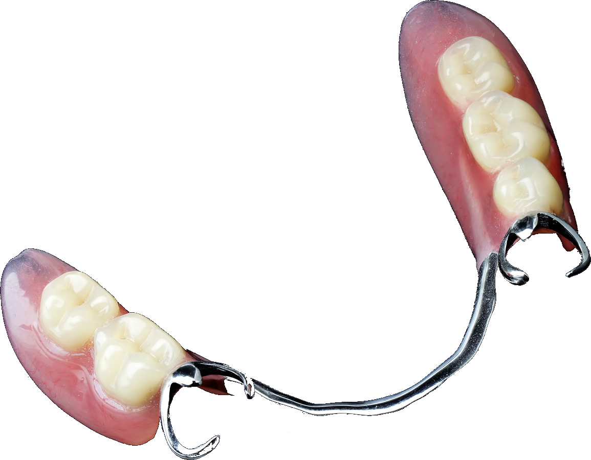 Fig 3. Partial Denture